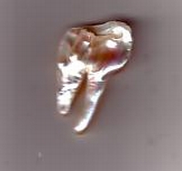 Perlenstück Steiler Zahn